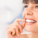 The Invisible Way to a Perfect Smile: Invisalign Success Stories from London