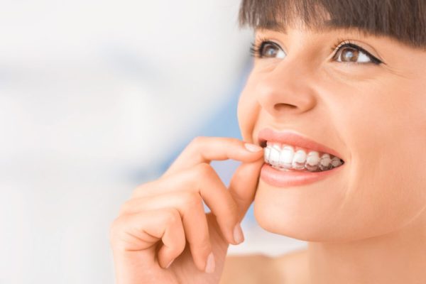 The Invisible Way to a Perfect Smile: Invisalign Success Stories from London